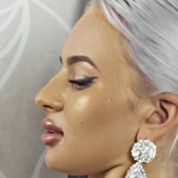 Florina Naken