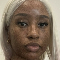 freckledn Naken