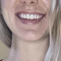 hotyoga Naken