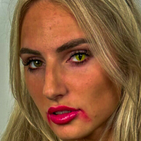 Xlicious Naken